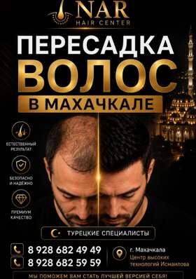 Нархаирцентр / Narhaircenter. Турецкий центр пересадки волос